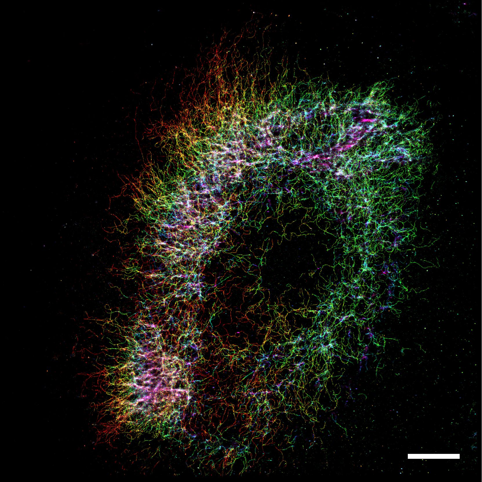 Iotm nov2021 vimentin 3d hp